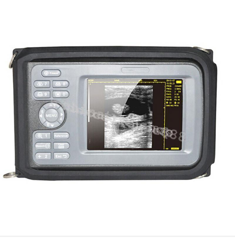 5.5 " Palmtop Ultrasound Machine Scanner Micro-convex Probe + Carry Box Human CE DIAGNOSTIC ULTRASOUND MACHINES FOR SALE