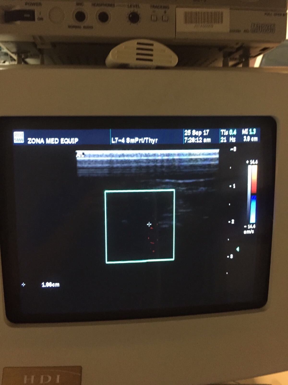 ATL Philips HDI 5000 SonoCT Ultrasound Machine with 2 probes DIAGNOSTIC ULTRASOUND MACHINES FOR SALE