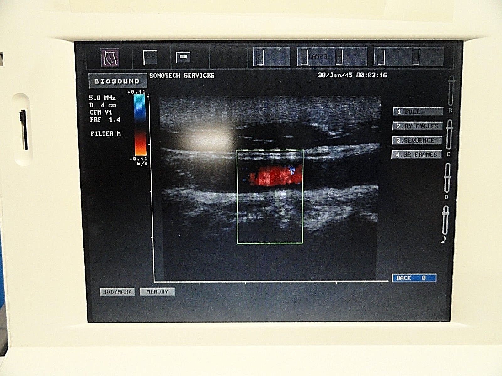 Biosound ESAOTE LA523 10-5 MHz Linear Array Ultrasound Transducer ~ 14901 DIAGNOSTIC ULTRASOUND MACHINES FOR SALE