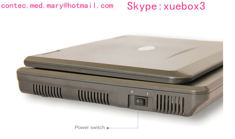 Portable laptop Digital Ultrasound scanner,pregnancy,Abdominal probe US seller 6945040100362 DIAGNOSTIC ULTRASOUND MACHINES FOR SALE