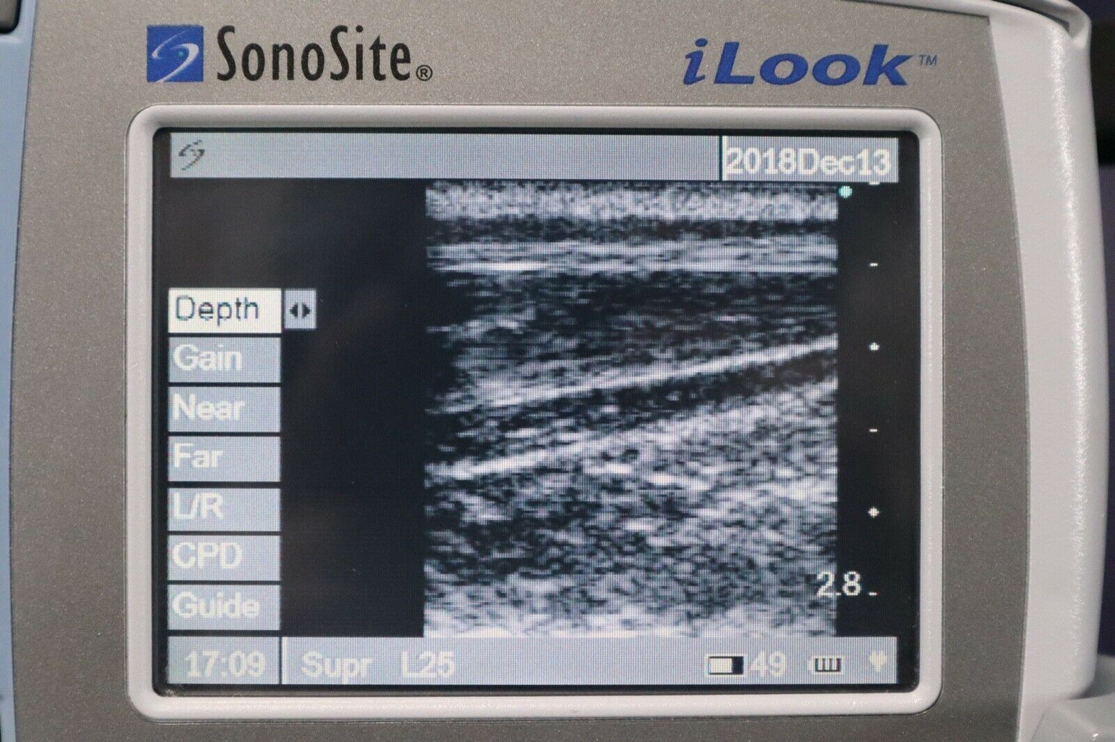 SONOSITE iLOOK PORTABLE ULTRASOUND SYSTEM DIAGNOSTIC ULTRASOUND MACHINES FOR SALE