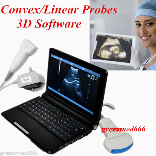 CE Laptop Ultrasound Scanner Digital Diagnostic System Linear+Abdominal Probe+3D DIAGNOSTIC ULTRASOUND MACHINES FOR SALE