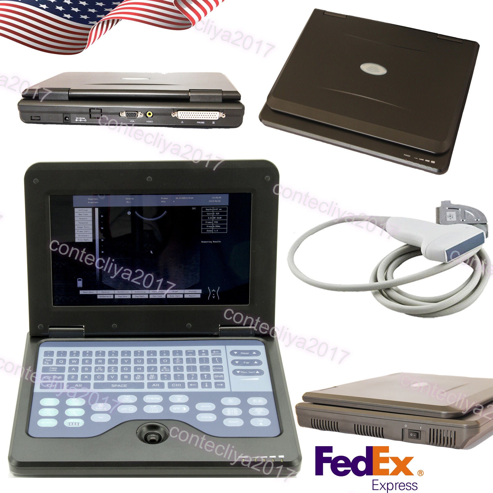 US Stock,Portable laptop machine Digital Ultrasound scanner, 7.5MHZ Linear probe 658126923446 DIAGNOSTIC ULTRASOUND MACHINES FOR SALE