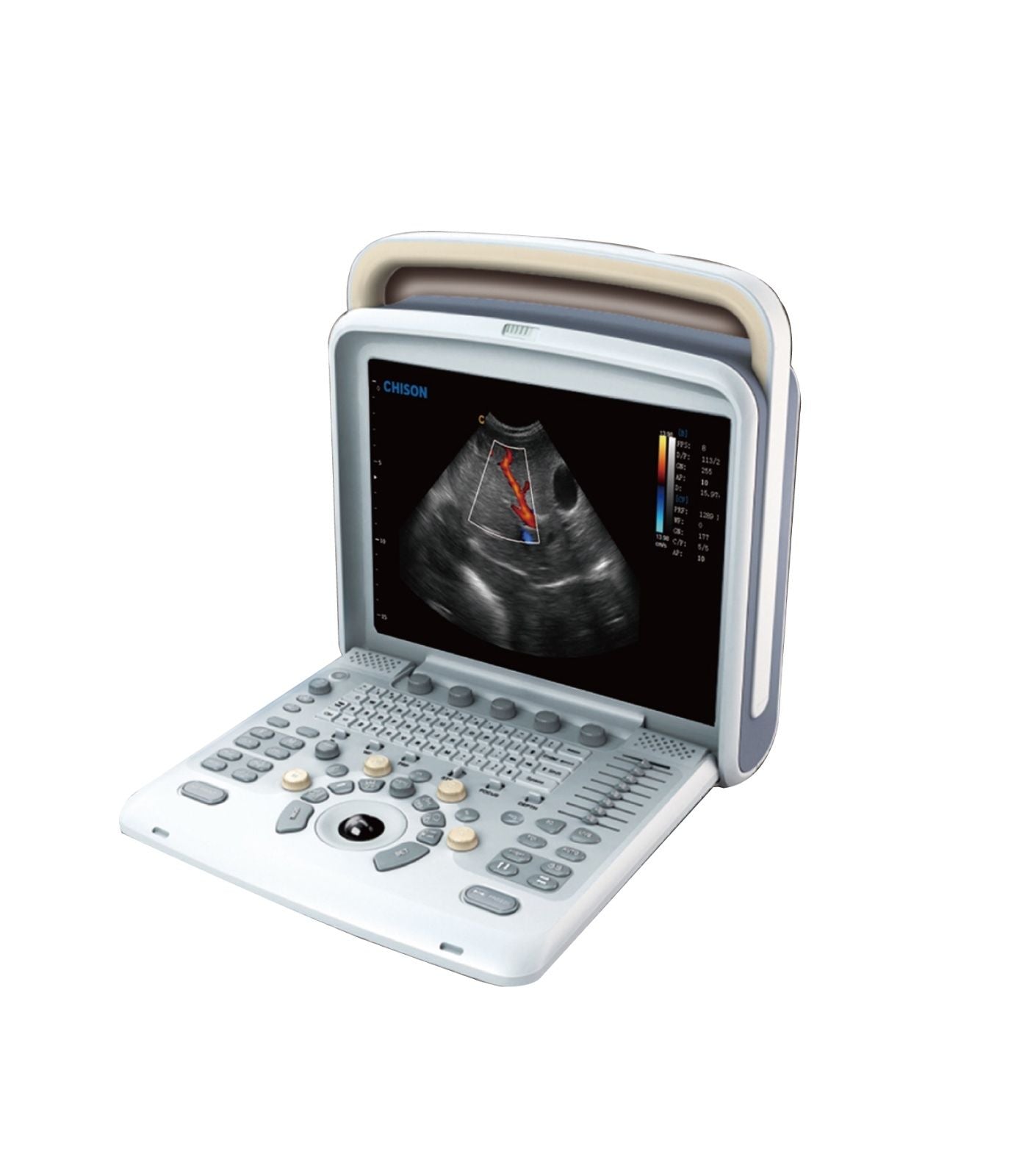 Chison Q5Vet Veterinary Color Doppler Ultrasound Machine-Equipment - Low Price DIAGNOSTIC ULTRASOUND MACHINES FOR SALE