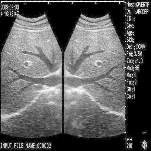 Vet Veterianry Ultrasound Scanner Monitor 3.5 Convex + 6.5Mhz Rectal Probes 3D DIAGNOSTIC ULTRASOUND MACHINES FOR SALE