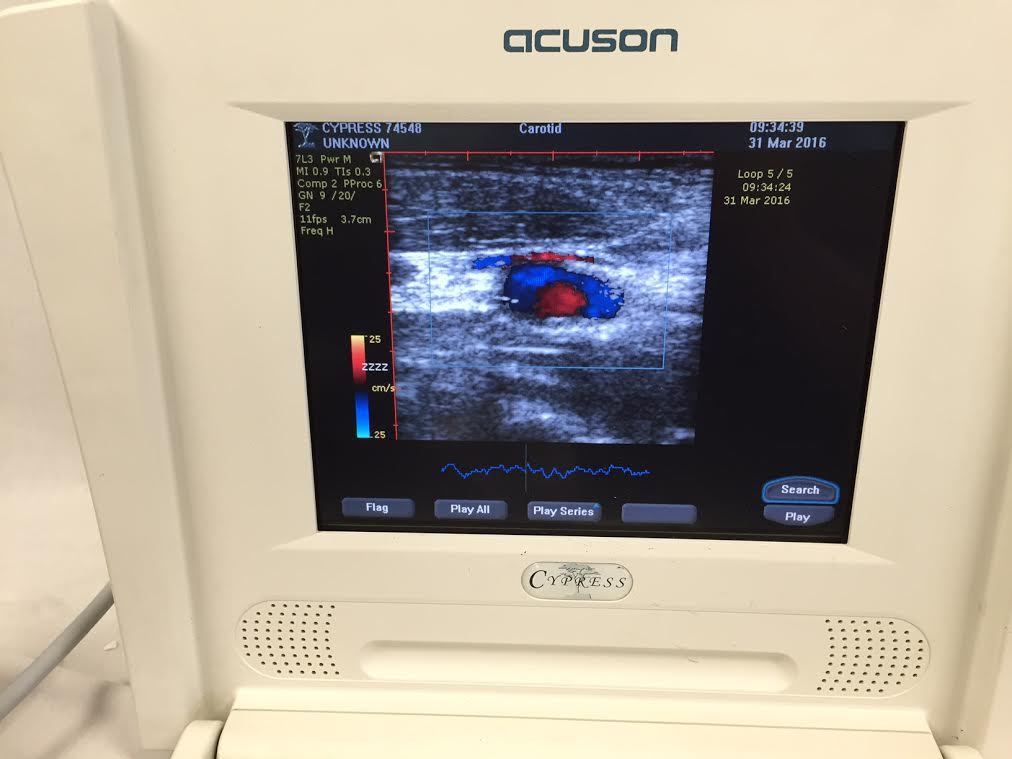 Acuson 7L3 Linear/Vascular Probe Transducer DIAGNOSTIC ULTRASOUND MACHINES FOR SALE