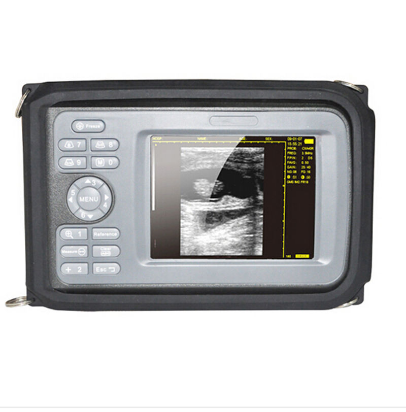 5.5Inch TFT Handheld Ultrasound Scanner/Machine  +Convex Probe + Case Human Use DIAGNOSTIC ULTRASOUND MACHINES FOR SALE