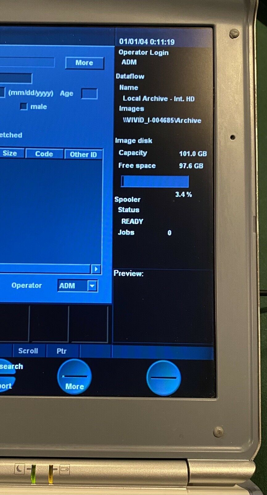 GE Vivid-i Ultrasound Machine (including carrying cases and two probes) DIAGNOSTIC ULTRASOUND MACHINES FOR SALE