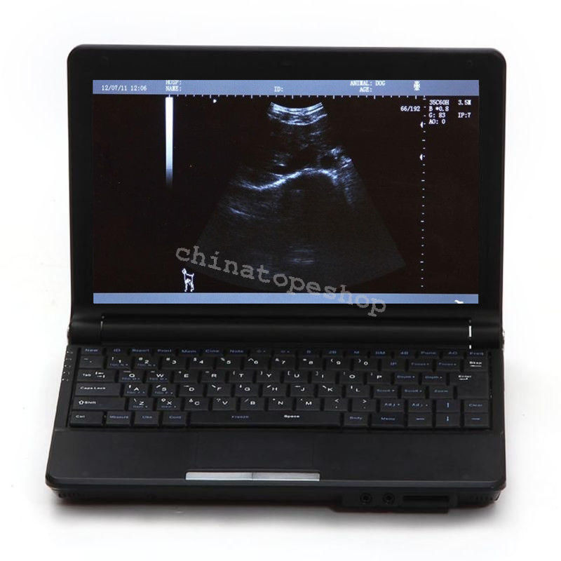 Digital Laptop Notebook ultrasound scanner machine Convex  Linear 2 probes 3D 190891559289 DIAGNOSTIC ULTRASOUND MACHINES FOR SALE