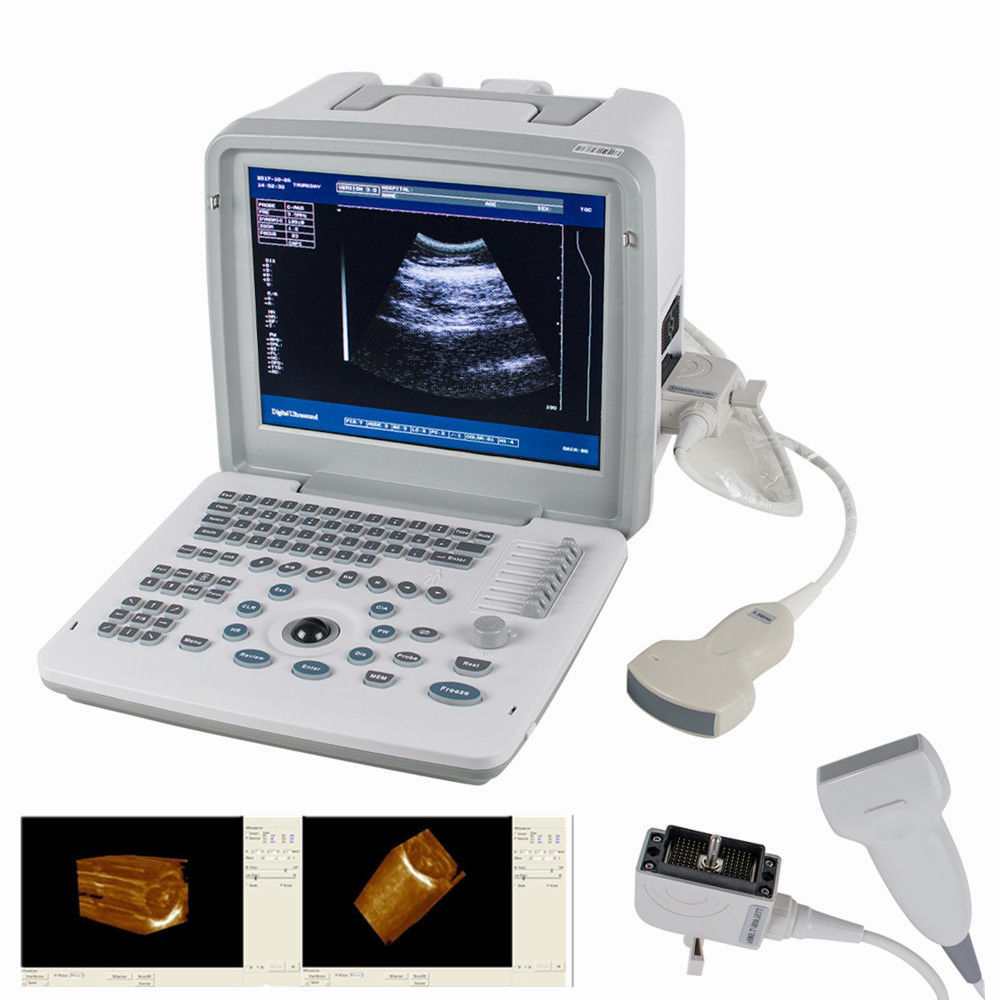 Digital SVGA 3D Portable Ultrasound Scanner Machine Convex  Linear 2 Probes MED 190891598837 DIAGNOSTIC ULTRASOUND MACHINES FOR SALE