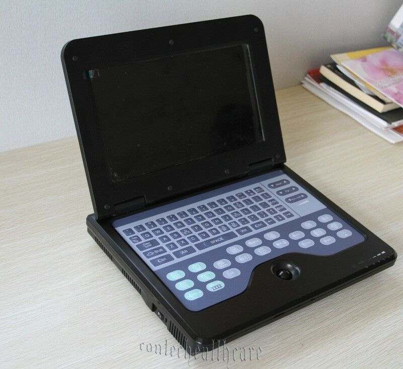 Full Digital B-Ultrasound diagnostic system Ultrasound Scanner 3.5M micro convex DIAGNOSTIC ULTRASOUND MACHINES FOR SALE