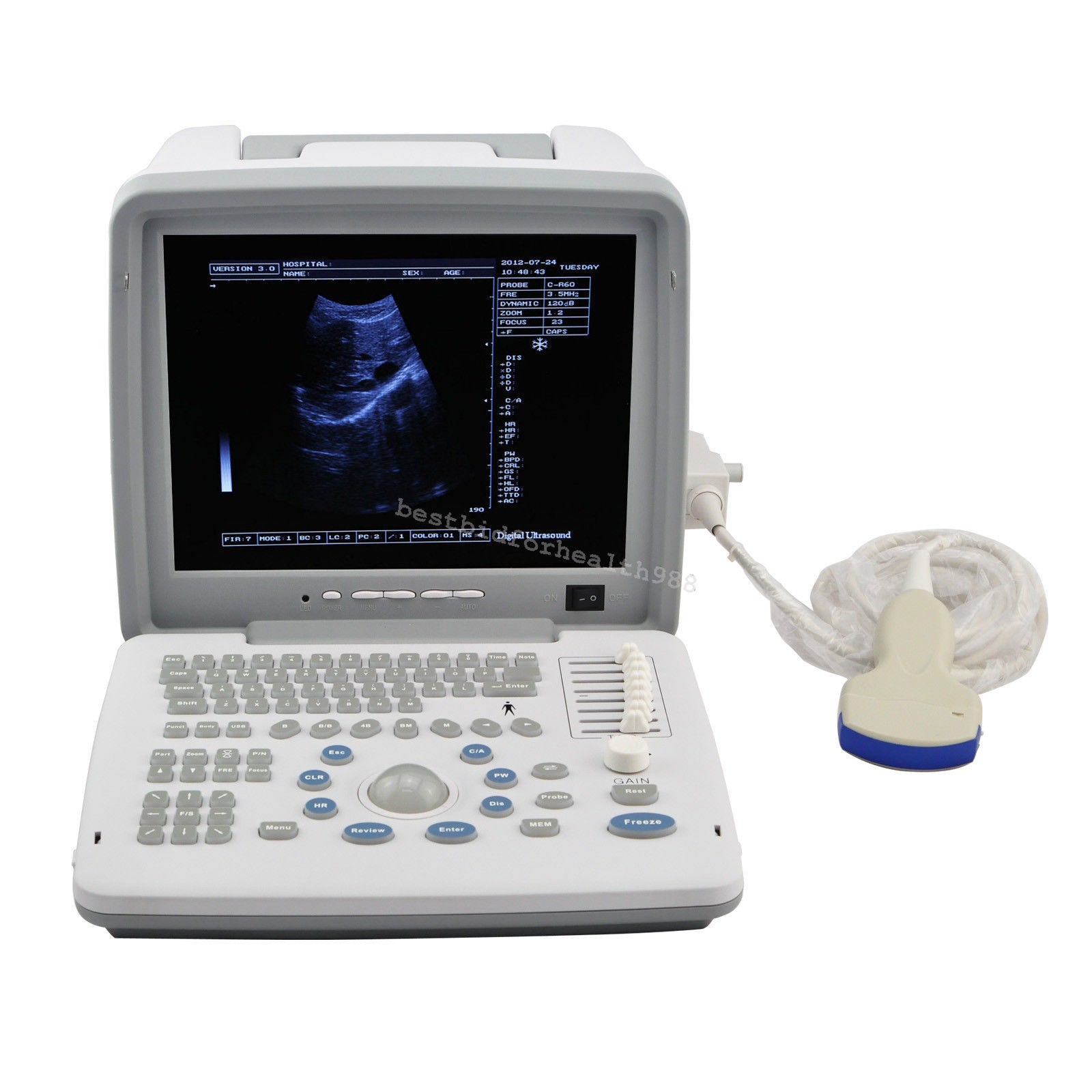 Ultrasound Scanner & Convex,Transvaginal, Linear Probe & 3D & Terminal Printer 190891563071 DIAGNOSTIC ULTRASOUND MACHINES FOR SALE