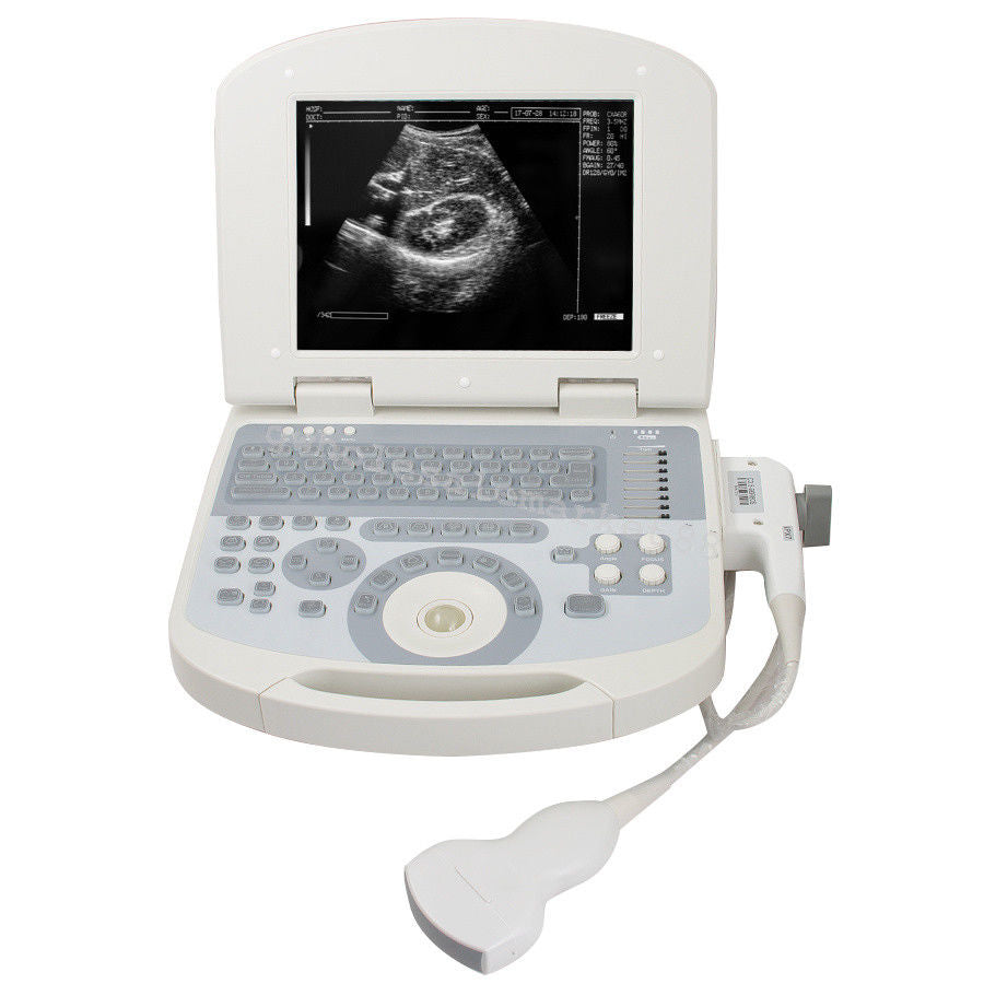 USA Laptop Hospital Ultrasound Machine Scanner Convex probe 3D High 96 Element 190891045898 DIAGNOSTIC ULTRASOUND MACHINES FOR SALE