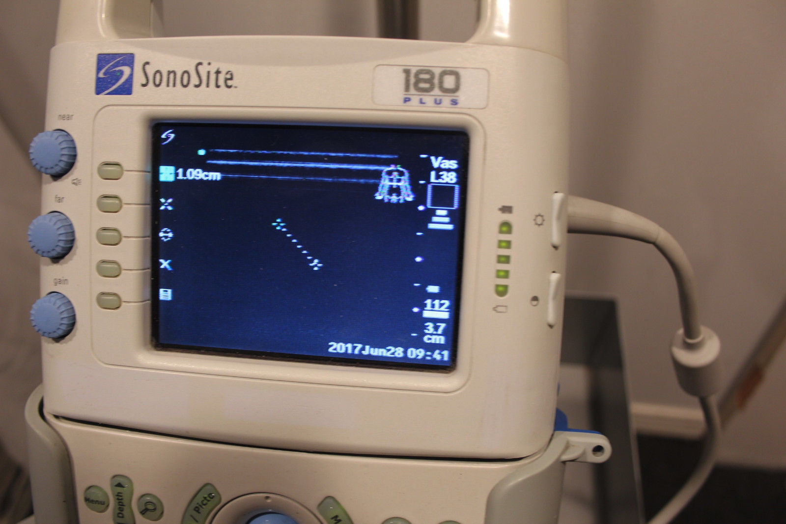 Sonosite 180plus Ultrasound System w/ L38 Linear & C11 Probes DIAGNOSTIC ULTRASOUND MACHINES FOR SALE