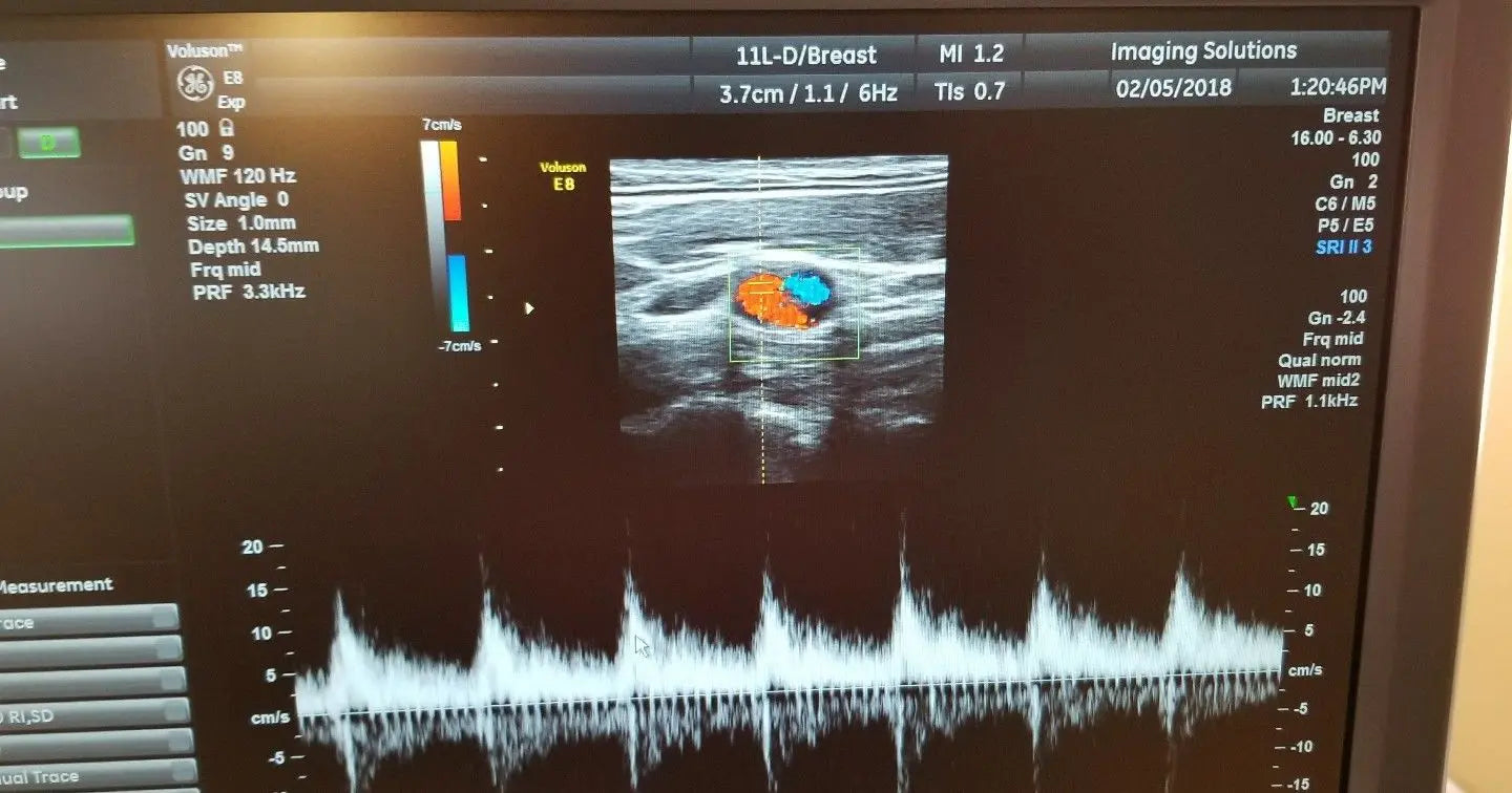 GE 11L-D Ultrasound Probe / Transducer DIAGNOSTIC ULTRASOUND MACHINES FOR SALE