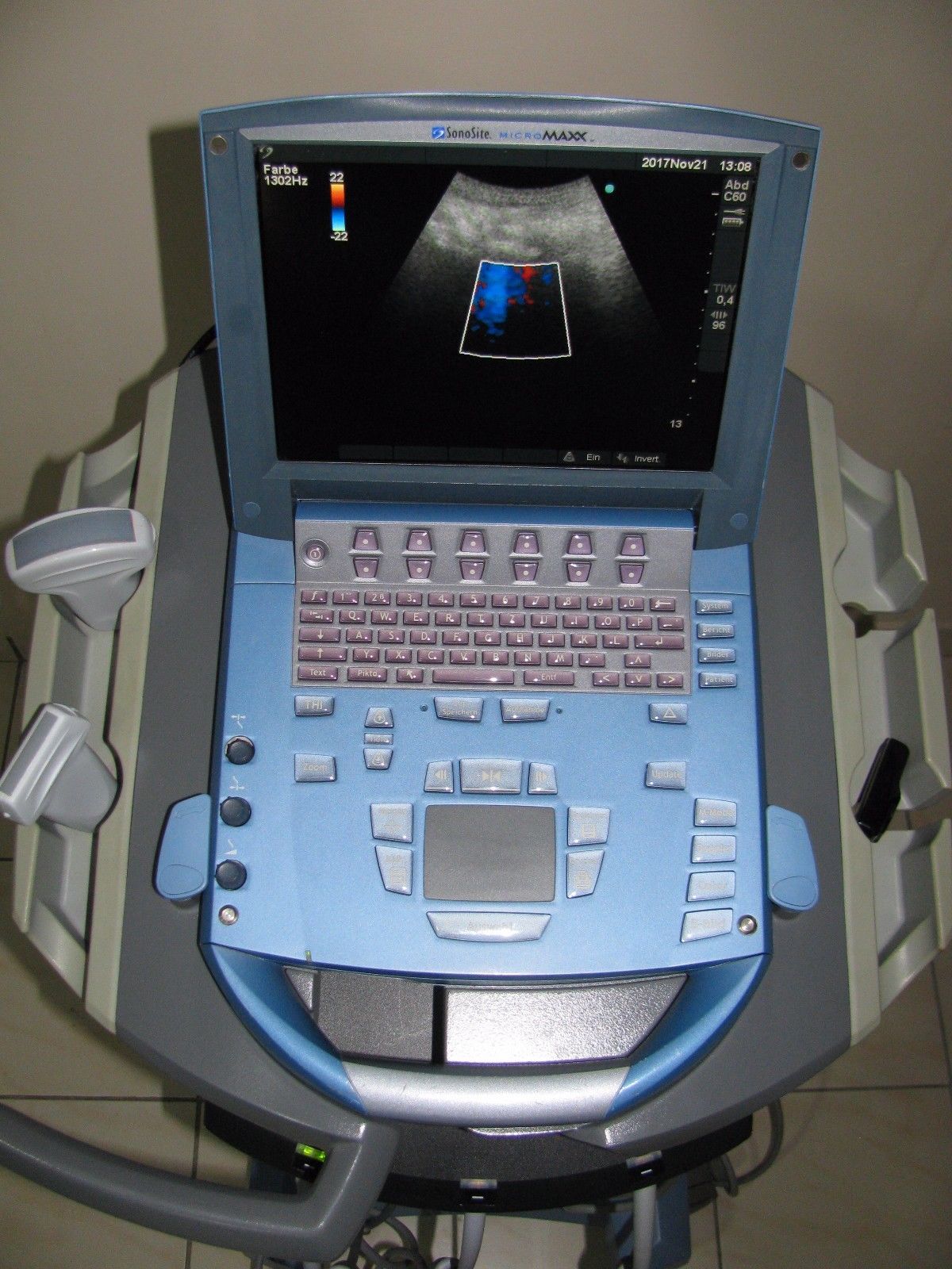 Ultrasound machine Sonosite Micromaxx with cart and three probes DIAGNOSTIC ULTRASOUND MACHINES FOR SALE