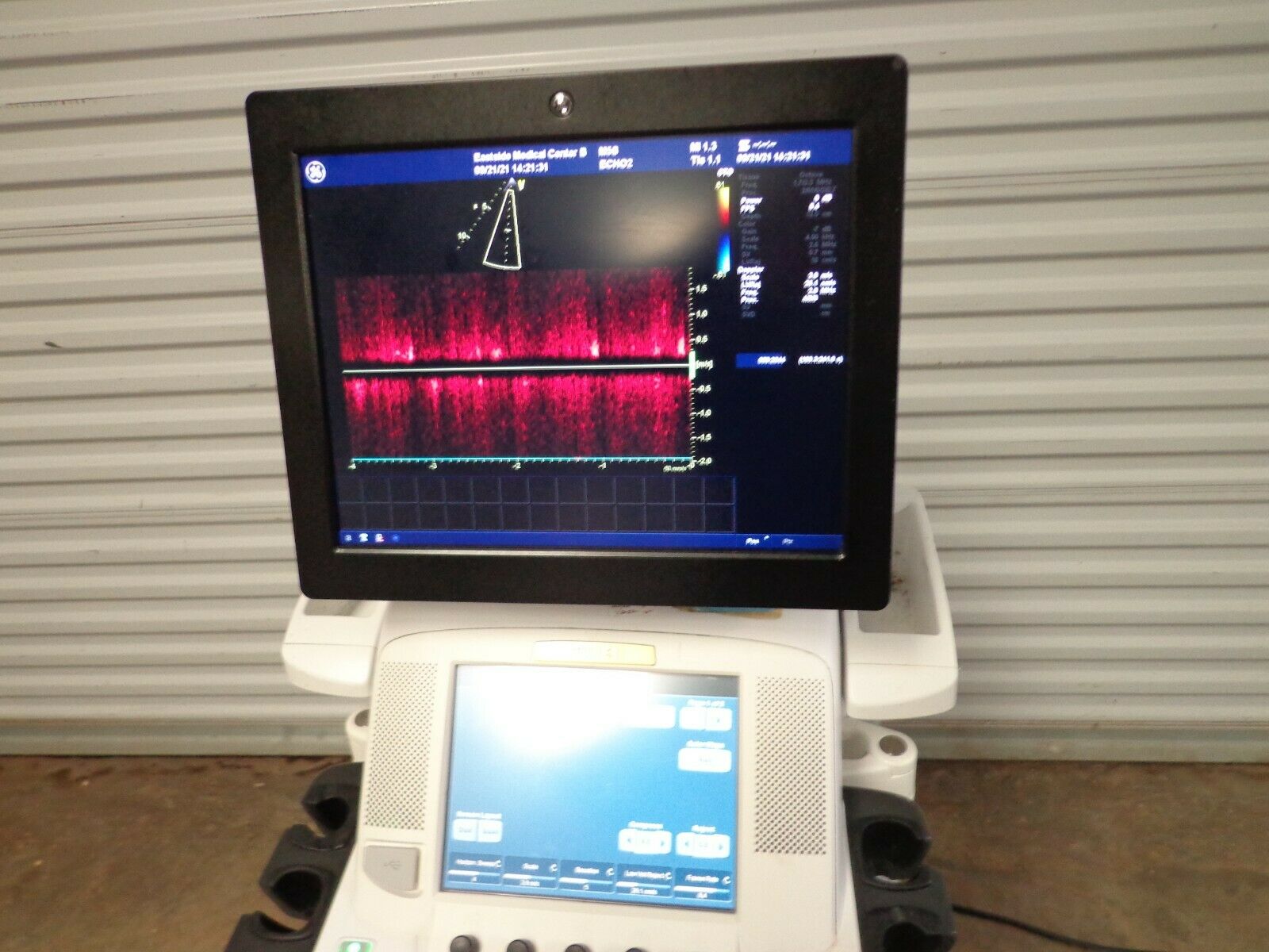 GE VIVID E9 Ultrasound System M5S Probe Color DIAGNOSTIC ULTRASOUND MACHINES FOR SALE