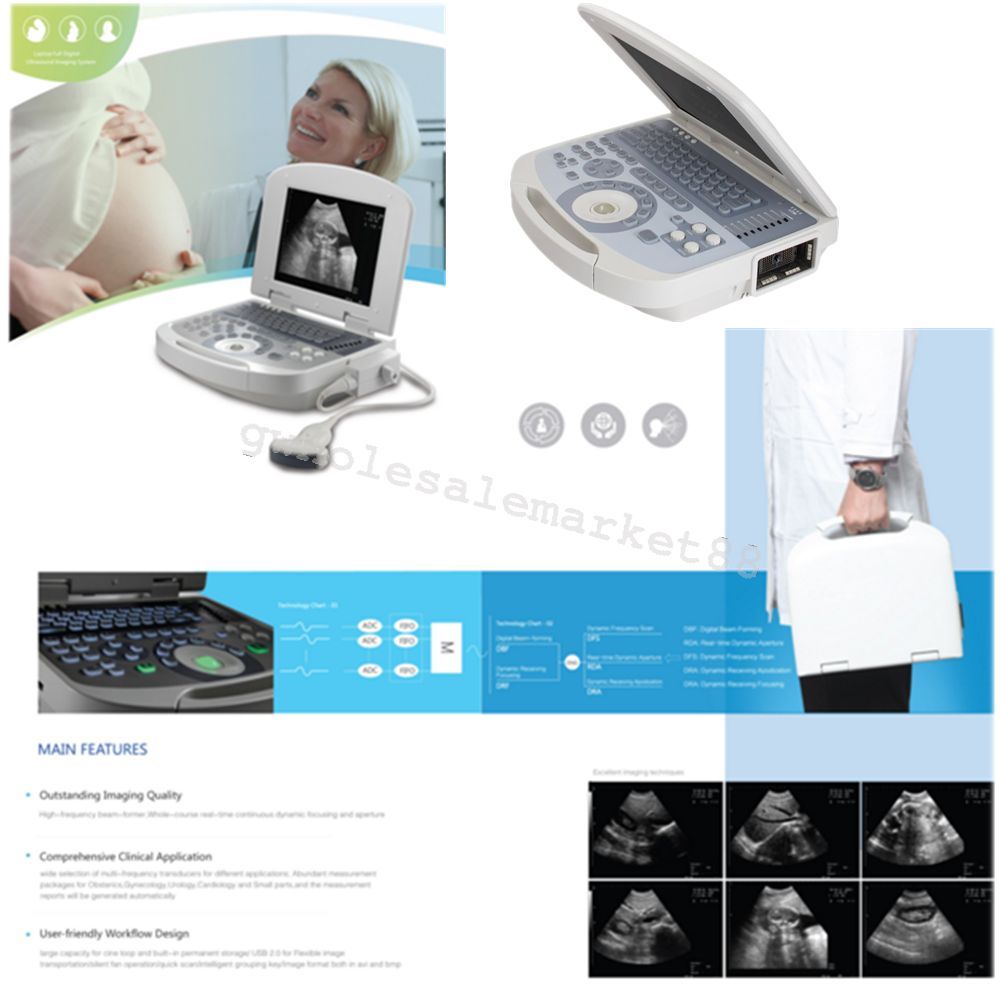 USA High 96 Element Clear Digital Laptop Ultrasound Scanner System +Convex probe 190891205612 DIAGNOSTIC ULTRASOUND MACHINES FOR SALE