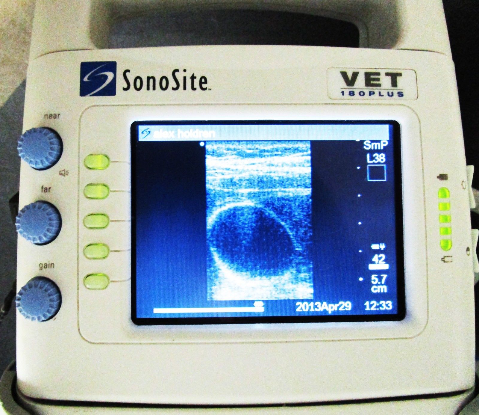 Sonosite 180 Plus VET Portable Ultrasound with L38/10-5 MHz Transducer Probe DIAGNOSTIC ULTRASOUND MACHINES FOR SALE