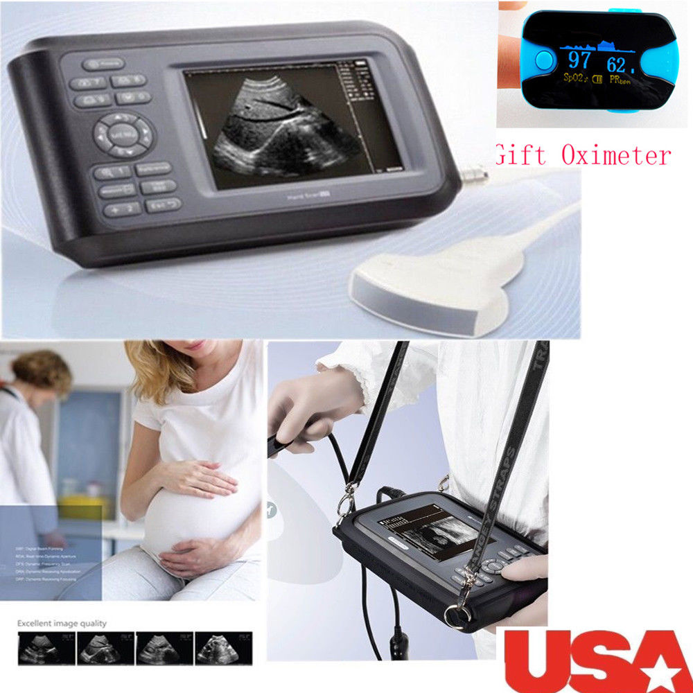 Precise New Medical Ultrasound Scanner Machine Convex Probe Abdominal +Oximeter 190891827272 DIAGNOSTIC ULTRASOUND MACHINES FOR SALE