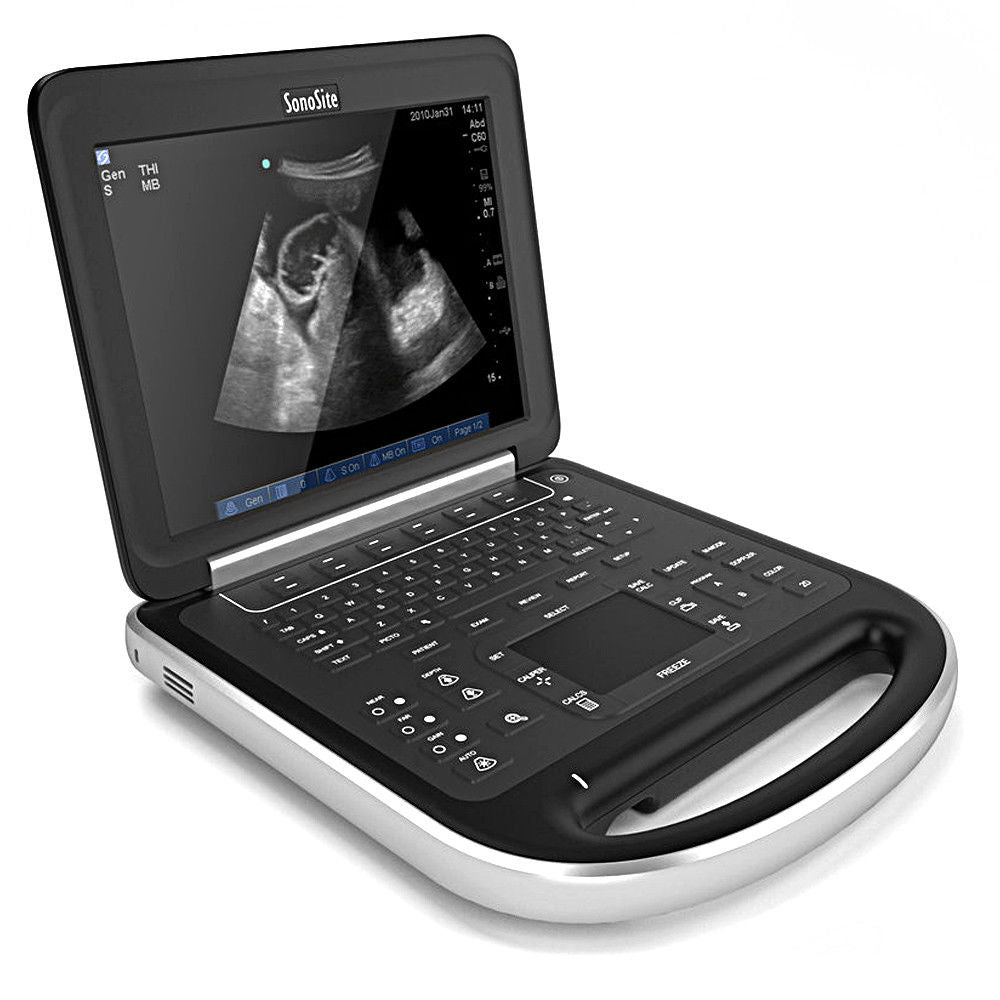 SonoSite Edge Ultrasound System Portable Machine with L38xi Vascular Transducer DIAGNOSTIC ULTRASOUND MACHINES FOR SALE