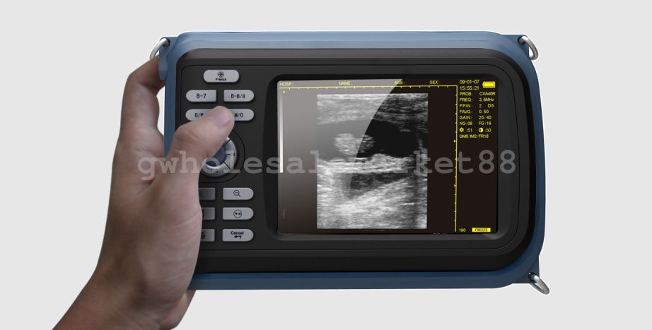 Veterinary Digital Palmtop Ultrasound Scanner Animal Rectal Probe Battery+ Case DIAGNOSTIC ULTRASOUND MACHINES FOR SALE