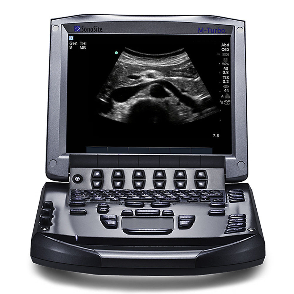 FUJIFILM Ultrasound Machine SonoSite M-Turbo - Portable System Shared Service DIAGNOSTIC ULTRASOUND MACHINES FOR SALE