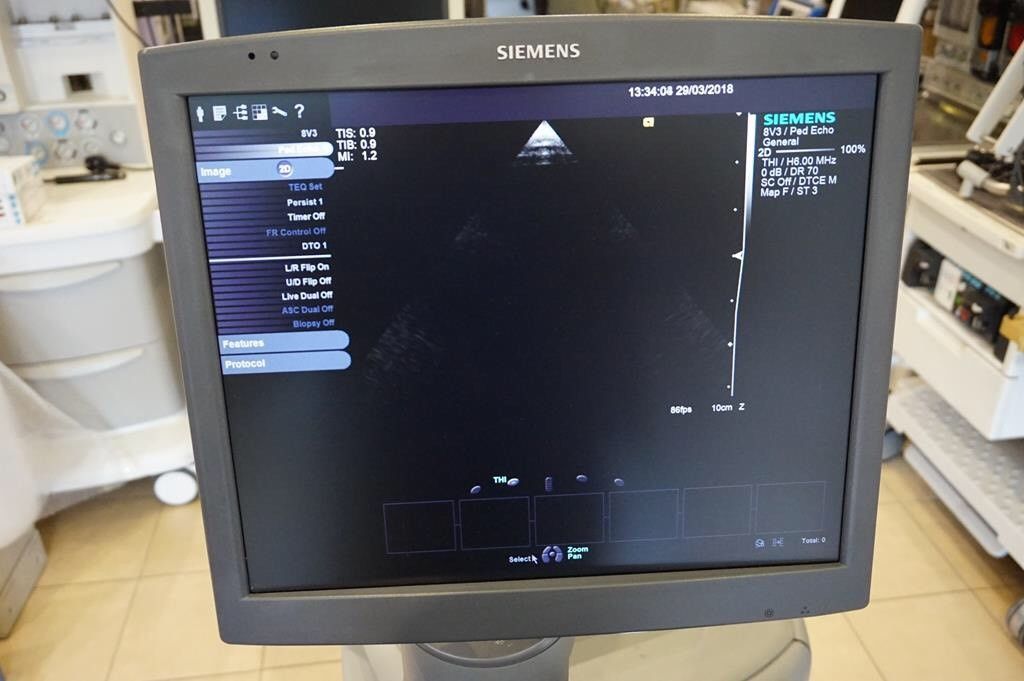 Siemens Acuson S2000 Cardiac Ultrasound system with 3 transducers DIAGNOSTIC ULTRASOUND MACHINES FOR SALE