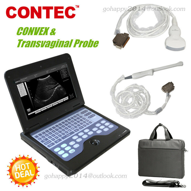 3.5Mhz CONVEX & transvaginal probe Portable Notebook Laptop Ultrasound Scanner  790996133775 DIAGNOSTIC ULTRASOUND MACHINES FOR SALE