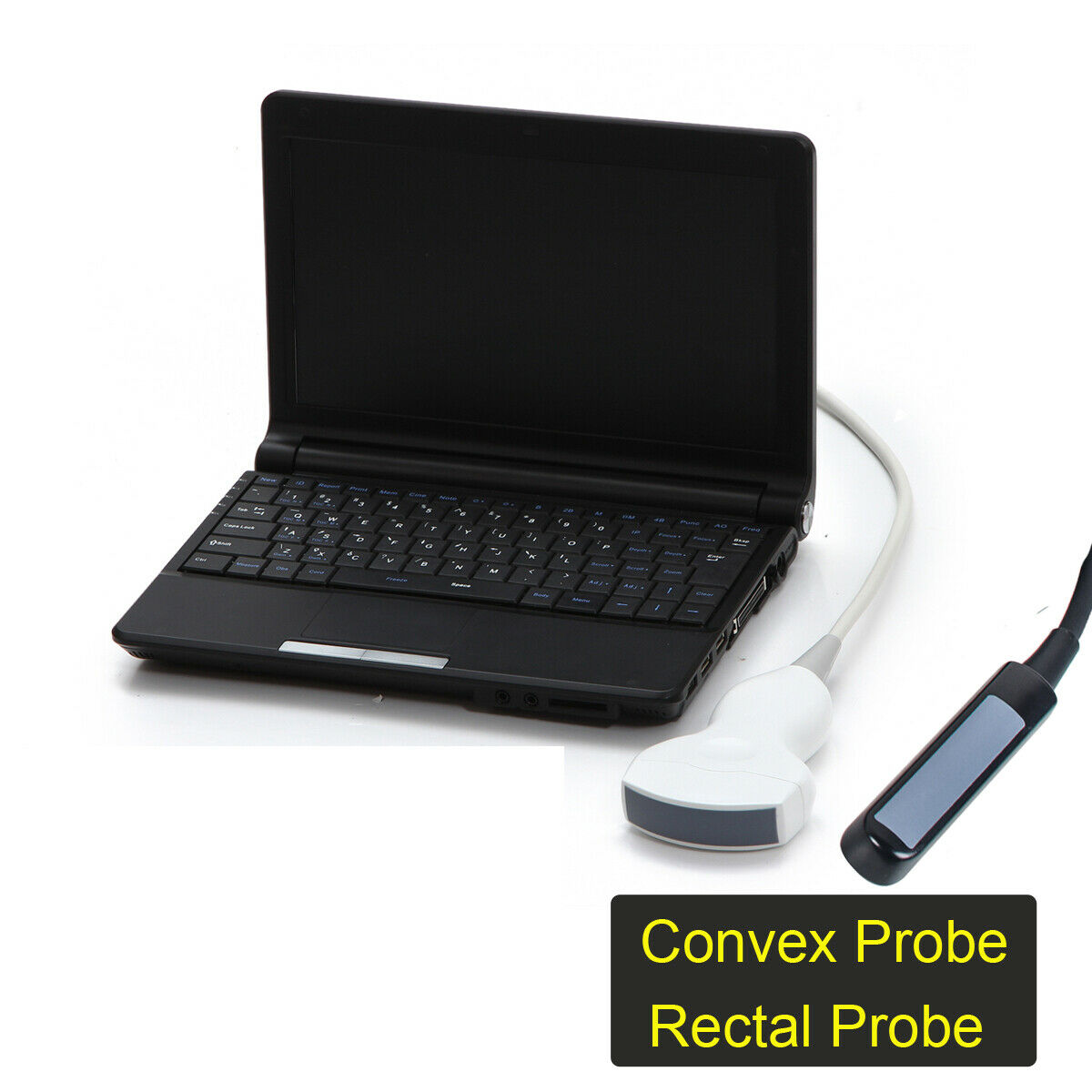 CE Portable laptop machine Digital Ultrasound scanner, Convex probe Rectal probe DIAGNOSTIC ULTRASOUND MACHINES FOR SALE