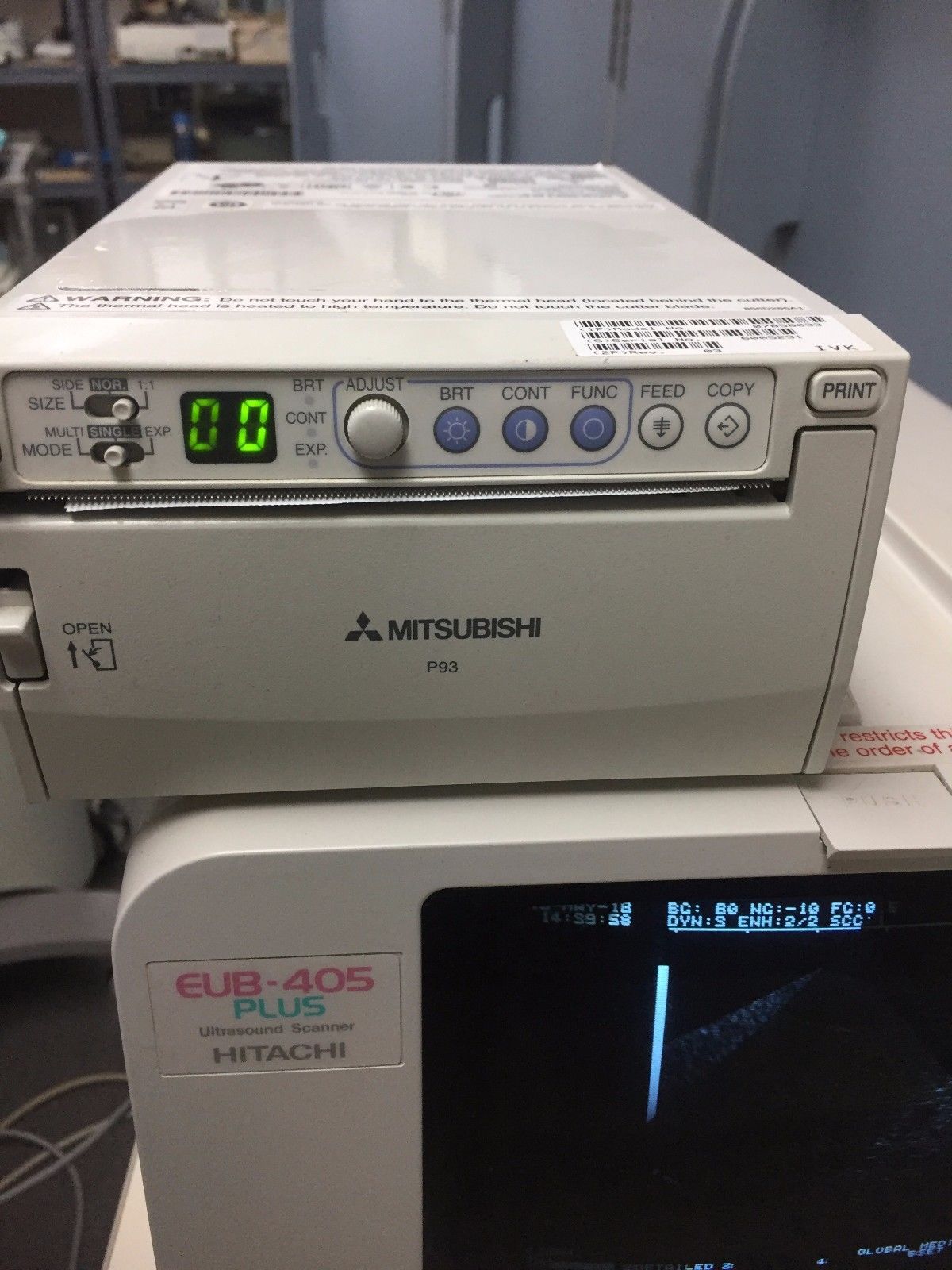 Hitachi EUB-405 Plus Ultrasound / 2 probes / 2 transducer port / printer DIAGNOSTIC ULTRASOUND MACHINES FOR SALE