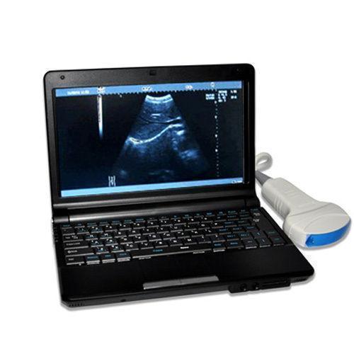 FULL Digital Laptop Ultrasound Scanner+Linear & Transvaginal 2 probe  3D Sale CE DIAGNOSTIC ULTRASOUND MACHINES FOR SALE