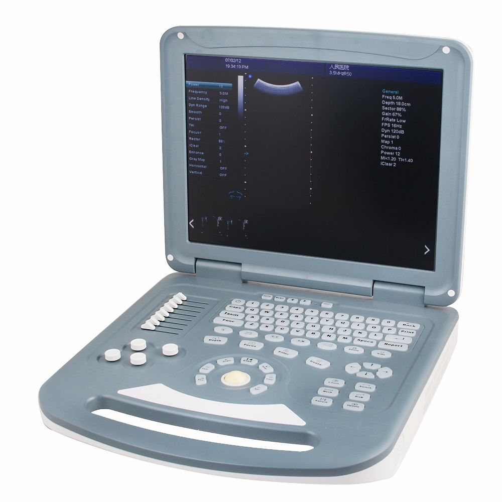 15"  Doppler Ultrasound Diagnostic System Scanner Convex Transvaginal 2 Probe A+ 190891646774 DIAGNOSTIC ULTRASOUND MACHINES FOR SALE