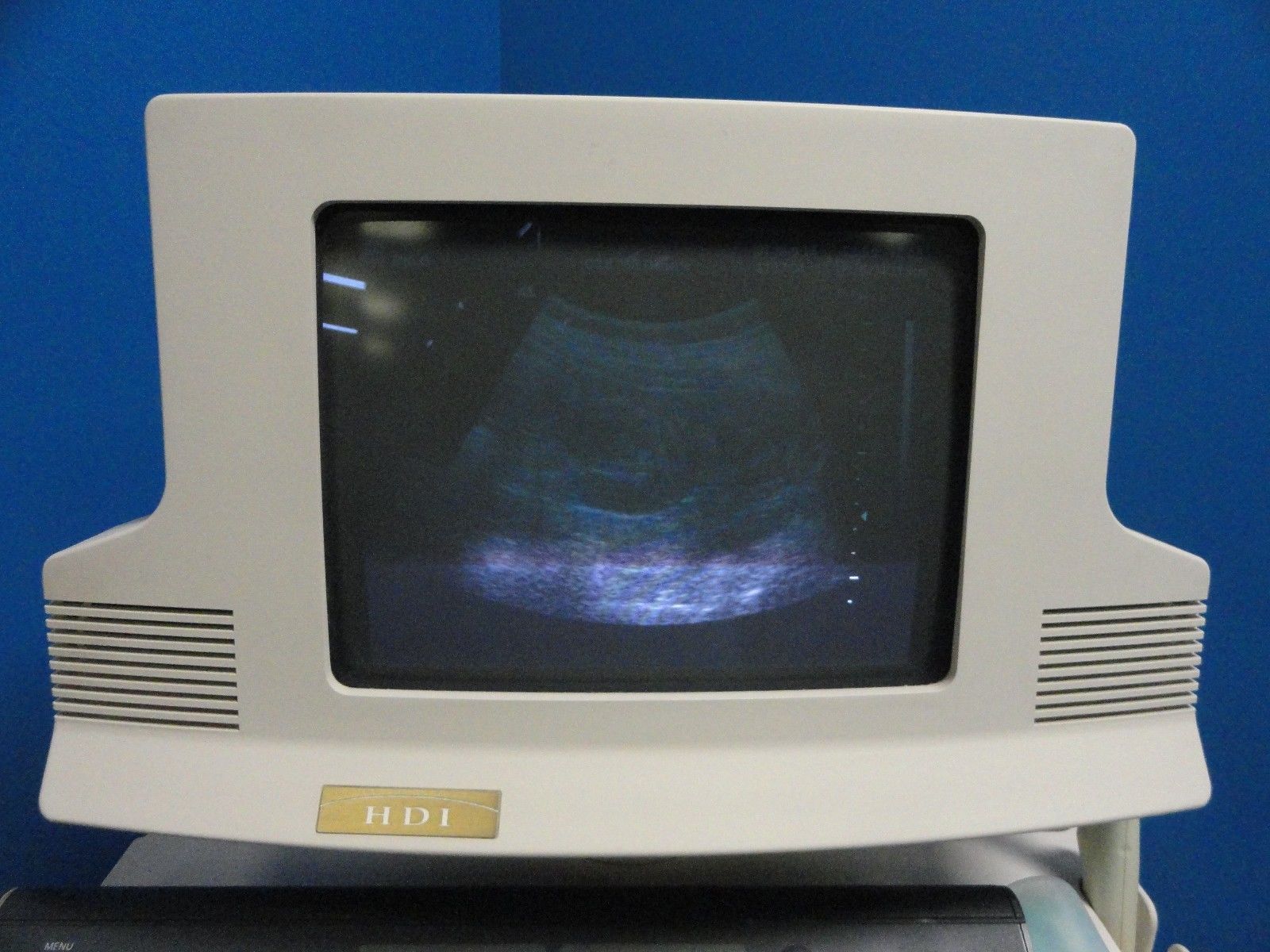 Philips ATL C3.5 76R  Convex / Curved Array Ultrasound Transducer Probe (8837) DIAGNOSTIC ULTRASOUND MACHINES FOR SALE