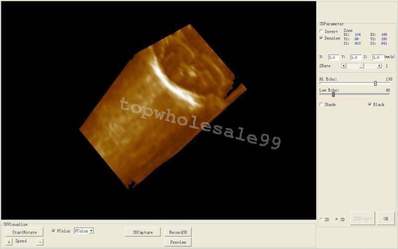 Veterinary Digital LCD Ultrasound Scanner, convex,Micro-convex probe,3D Software 190891975430 DIAGNOSTIC ULTRASOUND MACHINES FOR SALE