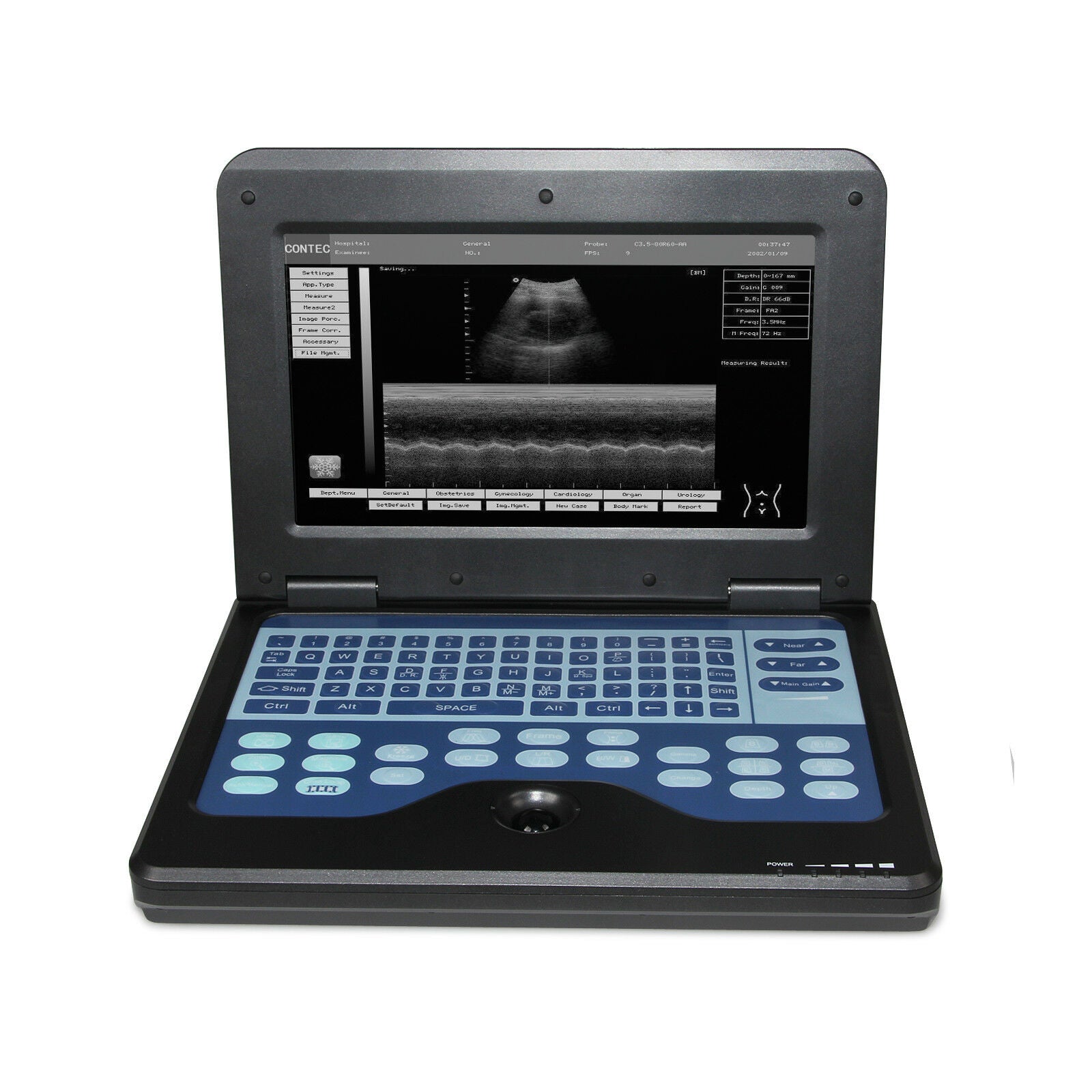 USA Ultrasound Scanner Laptop Diagnostic Ultrasonic Systems Convex+Linear Probe DIAGNOSTIC ULTRASOUND MACHINES FOR SALE