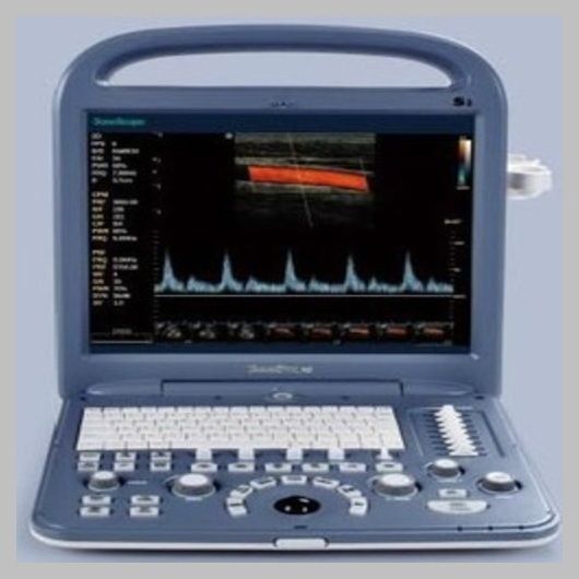 Used SonoScape S2 with Linear Array Probe L741 Excellent Condition,MSK,Vascular DIAGNOSTIC ULTRASOUND MACHINES FOR SALE