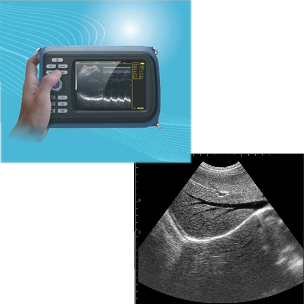 US Ship Diagnostic Ultrasound Scanner Machine Convex Probe+Free Pulse Oximeter DIAGNOSTIC ULTRASOUND MACHINES FOR SALE