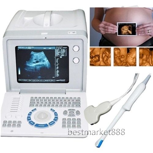 Top 10.1''LCD Digital Ultrasound Scanner with Convex Transvaginal Probes+Free 3D 190891802507 DIAGNOSTIC ULTRASOUND MACHINES FOR SALE