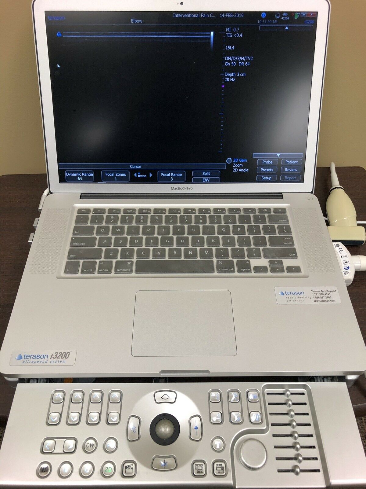 Terason t3200 MSK Ultrasound Unit - Excellent Condition DIAGNOSTIC ULTRASOUND MACHINES FOR SALE