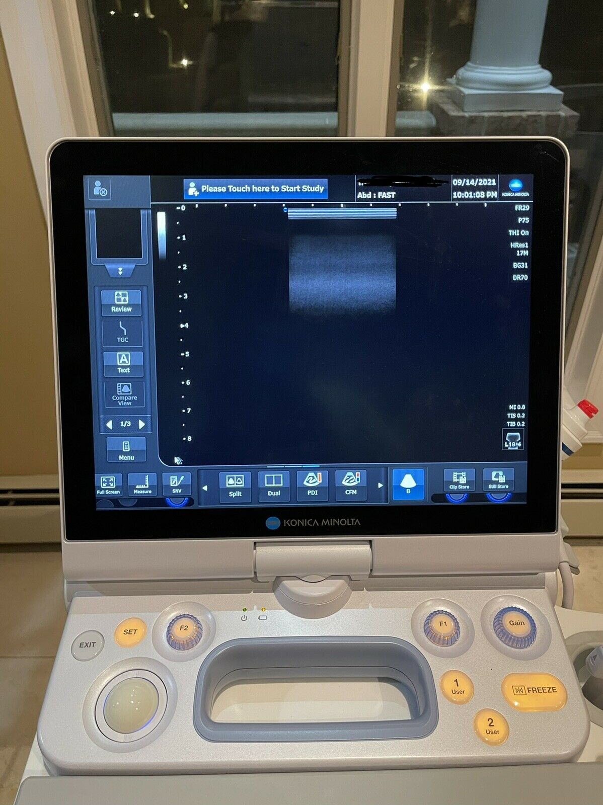 KONICA MINOLTA SONIMAGE HS1 PORTABLE ULTRASOUND MACHINE Full Warranty 2 Probes DIAGNOSTIC ULTRASOUND MACHINES FOR SALE