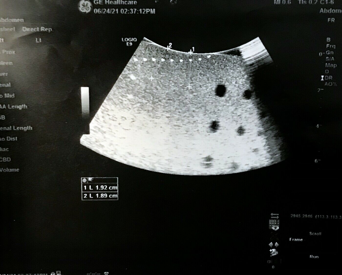 GE C1-6VN-D Curved Array Ultrasound Transducer Probe DIAGNOSTIC ULTRASOUND MACHINES FOR SALE