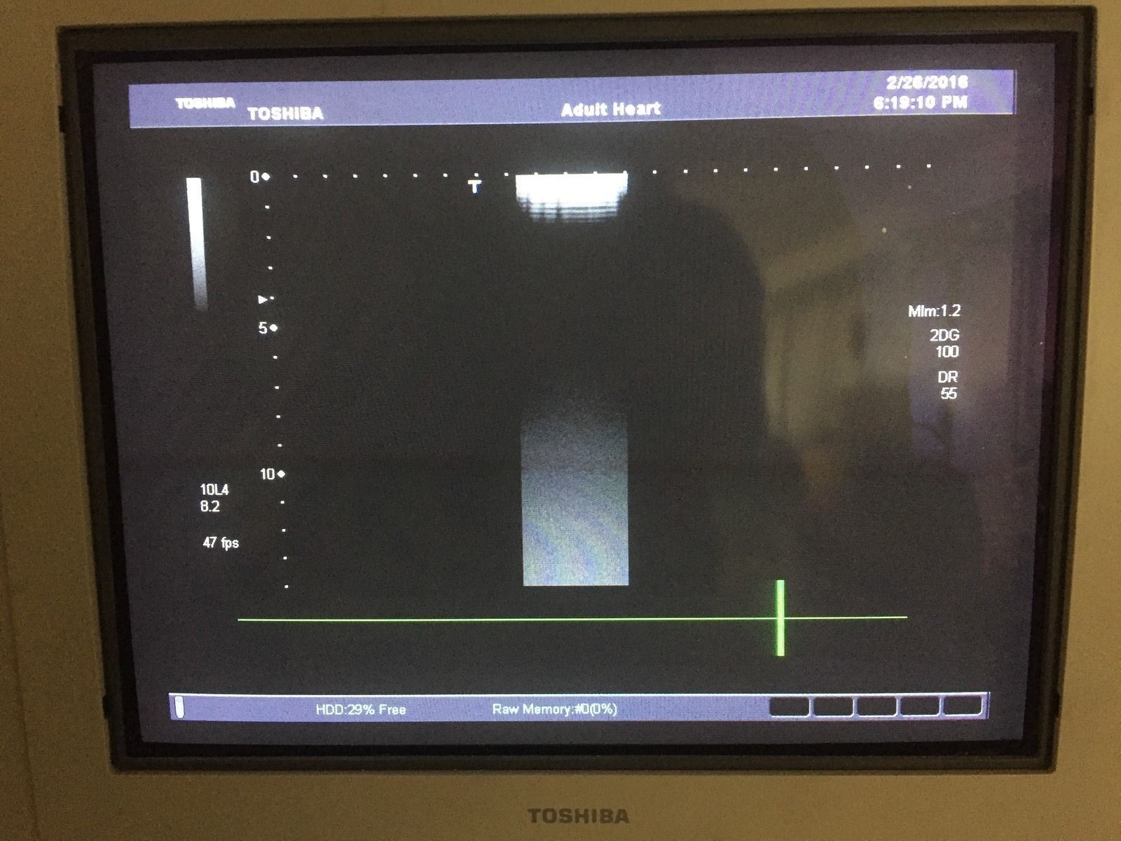 Toshiba Aplio 500 PLT-604AT 6MHz Linear Ultrasound Transducer DIAGNOSTIC ULTRASOUND MACHINES FOR SALE