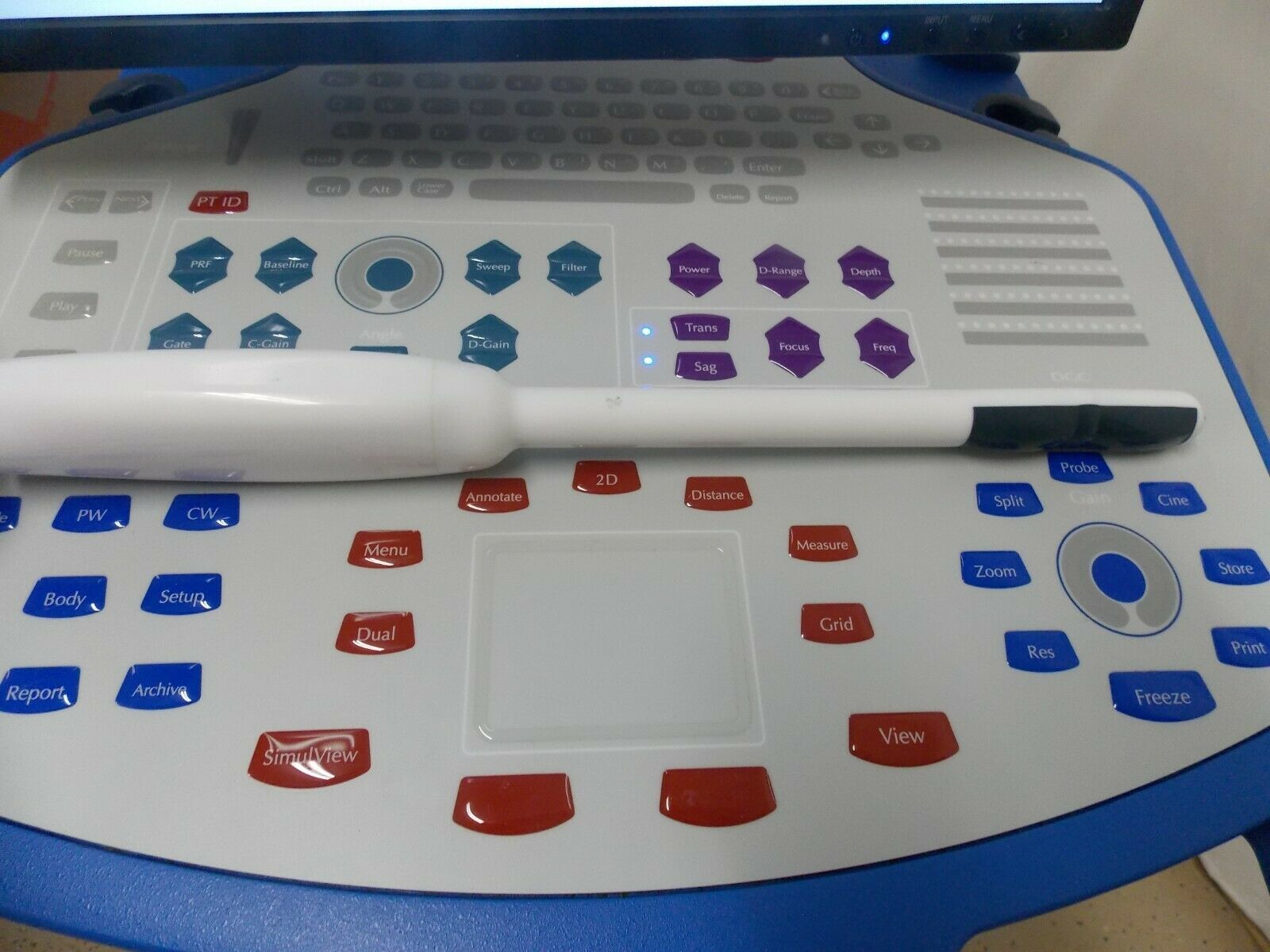 NOMOS P/N 206,326 SONALIS Ultrasound Imaging System DIAGNOSTIC ULTRASOUND MACHINES FOR SALE