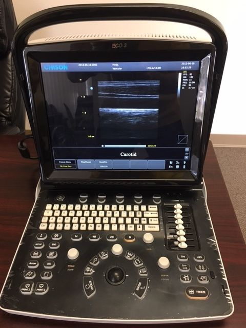 Chison ECO 3 Portable Ultrasound System DIAGNOSTIC ULTRASOUND MACHINES FOR SALE