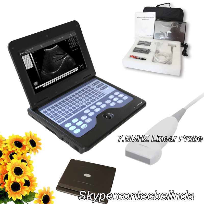 CE Portable Ultrasound Scanner Machine Laptop Diagnostic System(4 Probes Option) DIAGNOSTIC ULTRASOUND MACHINES FOR SALE