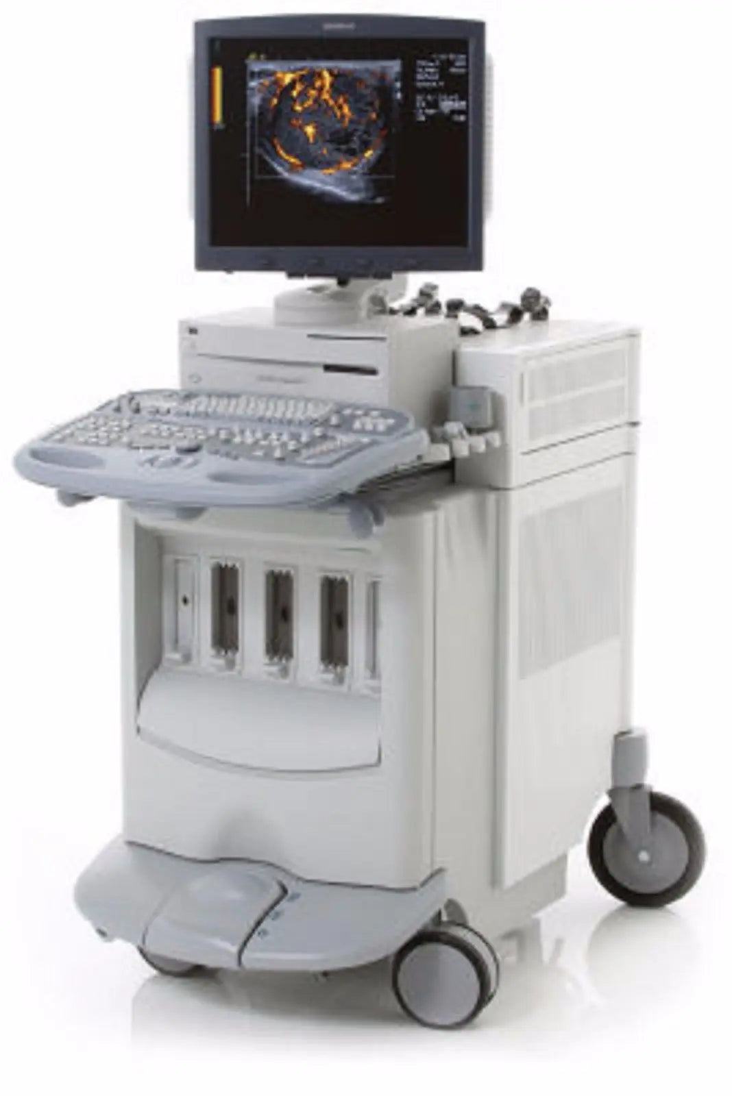 Siemens/Acuson Sequoia C512 Ultrasound *Probes *1 Year Parts Warranty Included DIAGNOSTIC ULTRASOUND MACHINES FOR SALE