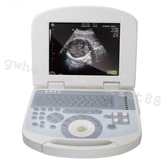 USA Portable Digital Laptop Medical Ultrasound Scanner 3.5MHZ Convex Probe +3D 190891422491 DIAGNOSTIC ULTRASOUND MACHINES FOR SALE