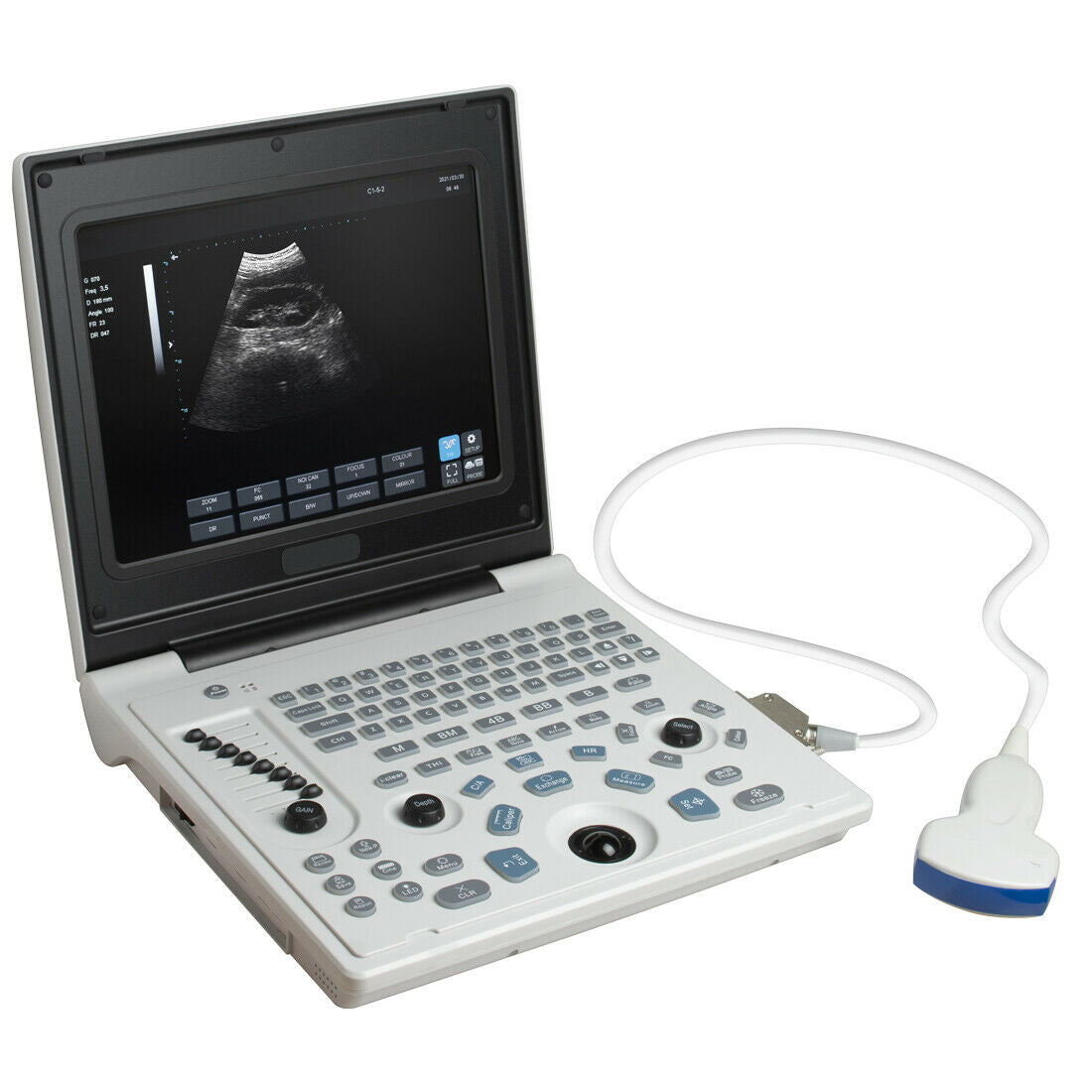 Portable LED Ultrasound Scanner Laptop Machine Ultrasonic Systems +Convex Probe DIAGNOSTIC ULTRASOUND MACHINES FOR SALE