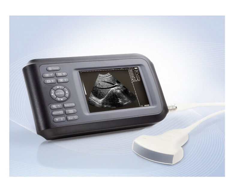 5.5 inch Handheld Ultrasound Scanner Laptop Machine With Convex Probe Human Use DIAGNOSTIC ULTRASOUND MACHINES FOR SALE